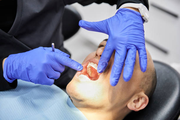 Best Emergency Treatment for Oral Infections in West Puente Valley, CA